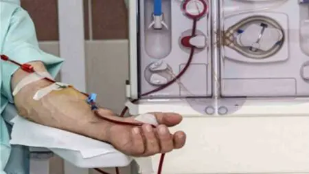 “مؤشر” الحكومة يهدد حياة المئات من مرضى القصور الكلوي