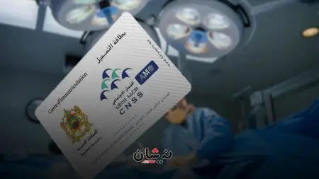 شبهات سمسرة واحتيال مالي تلاحق حملات طبية لإزالة “الجلالة”
