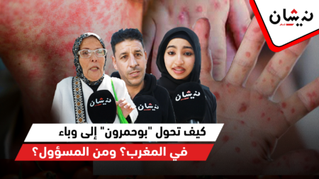 كيف تحول “بوحمرون” إلى وباء في المغرب؟ ومن المسؤول؟