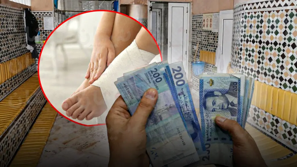 تعويض بـ 25 مليون سنتيم لرجل أصيب في حمام بالدار البيضاء