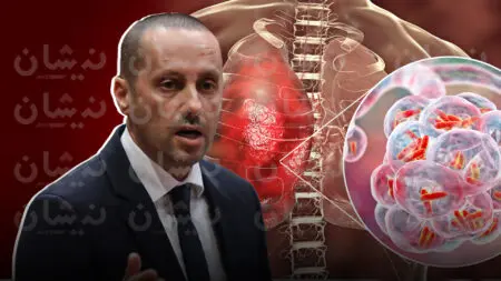 وزارة الصحة: 53% من حالات السل المسجلة بالمغرب خارج الرئة